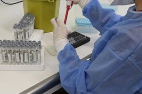 dsoden-kovid-19un-yeni-varyantlari-karsisinda-daha-fazla-test-cagrisi