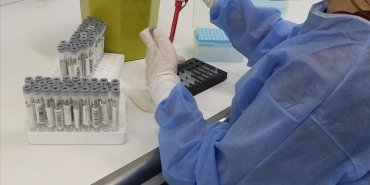 dsoden-kovid-19un-yeni-varyantlari-karsisinda-daha-fazla-test-cagrisi