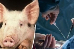 domuz-bobregi-nakli-operasyonu-ve-ksenotransplantasyon-tedavisi-XgCCbjar.jpg