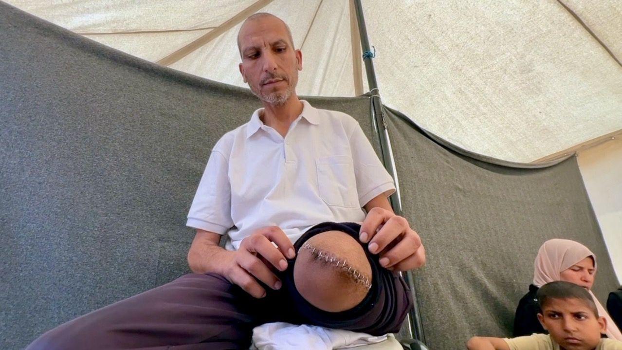 Filistinli Hastaların İsrail'deki Kötü Muamelesi