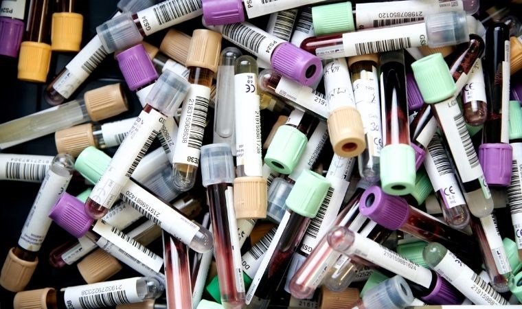 Kan Pıhtılarında Mikroplastik Var!
