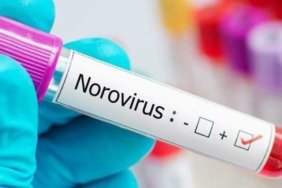 noroviruslerin-bulasma-yollari-ve-belirtileri-DL2PIanL.jpg