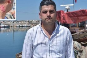 suat-barmanin-yanik-izi-macerasi-ve-hukuki-sureci-a9vAVdnV.jpg