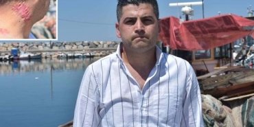 suat-barmanin-yanik-izi-macerasi-ve-hukuki-sureci-a9vAVdnV.jpg
