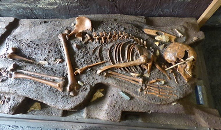 İlişkili Cesetler ve DNA Analizi