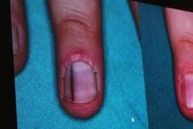 6-karadeniz-dermatolojide-yenilikler-sempozyumu-67c5U4cu.jpg