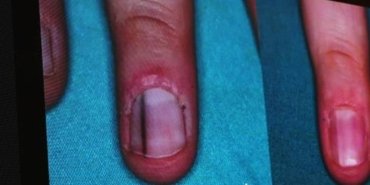 6-karadeniz-dermatolojide-yenilikler-sempozyumu-67c5U4cu.jpg