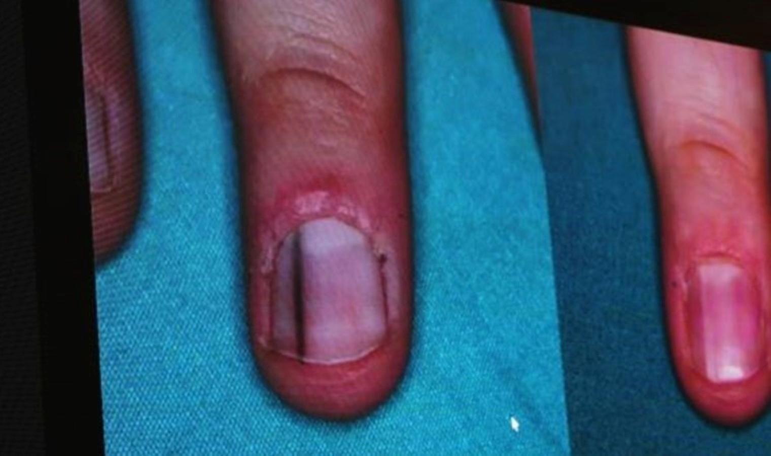 6-karadeniz-dermatolojide-yenilikler-sempozyumu-67c5U4cu.jpg