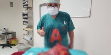64-yasindaki-kadinin-dev-tumor-ameliyati-basarili-gecirildi-iadFcLdY.jpg