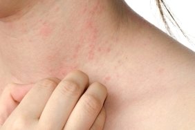 alerji-vakalarinda-artis-nedenler-ve-onlemler-CVUXSqiU.jpg