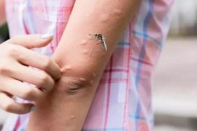 dermatoloji-uzmani-doc-dr-havva-hilal-ayvaz-celikten-sivrisinek-isiriklari-hakkinda-bilgilendirme-vRDZwh2Y.jpg
