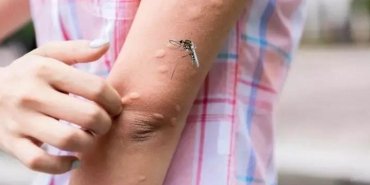 dermatoloji-uzmani-doc-dr-havva-hilal-ayvaz-celikten-sivrisinek-isiriklari-hakkinda-bilgilendirme-vRDZwh2Y.jpg