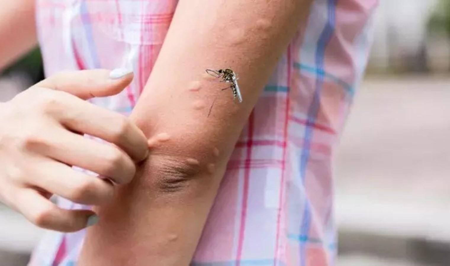 dermatoloji-uzmani-doc-dr-havva-hilal-ayvaz-celikten-sivrisinek-isiriklari-hakkinda-bilgilendirme-vRDZwh2Y.jpg
