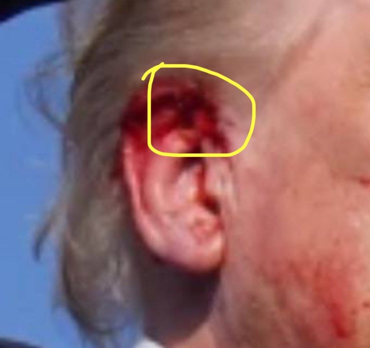 Trump'un Suikast Girişimi