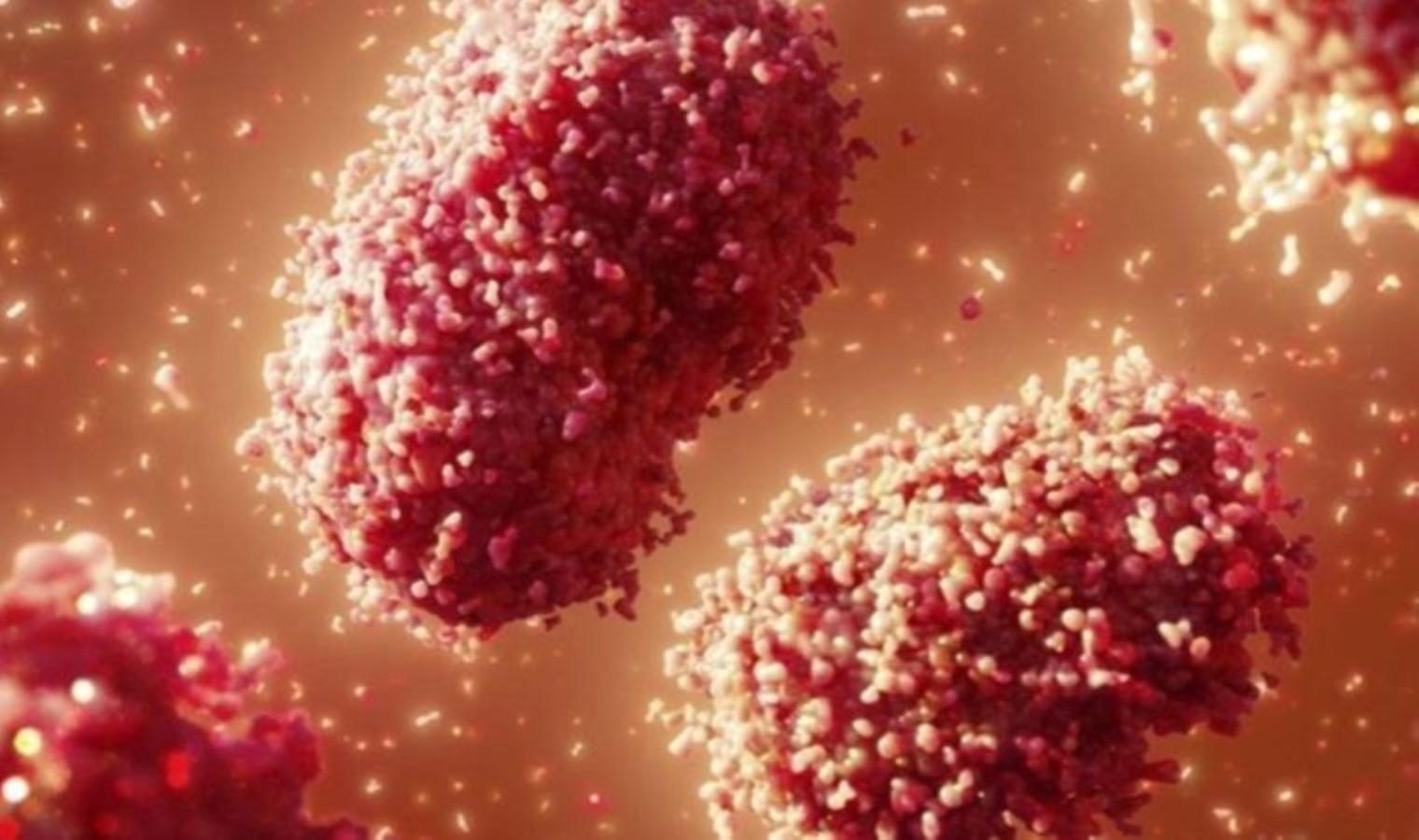 maymun-cicegi-mpox-vaka-artisi-ve-onlemler-djOS4OIB.jpg