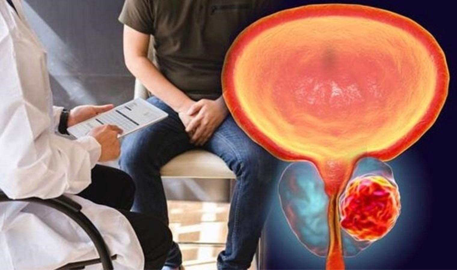 her-19-kisiden-1inin-prostat-kanseri-riski-bilinclenmenin-onemi-cw6jTvni.jpg