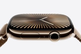 ceo-gitti-apple-watch-icin-yeni-bir-umut-isigi-dogdu-Q5uTDLaW.jpg