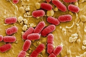 floridada-kasirga-sonrasi-et-yiyen-bakteri-vakalari-artti-hizlica-yayilan-virus-sebebiyle-13-kisi-oldu-T7IMqUbz.jpg