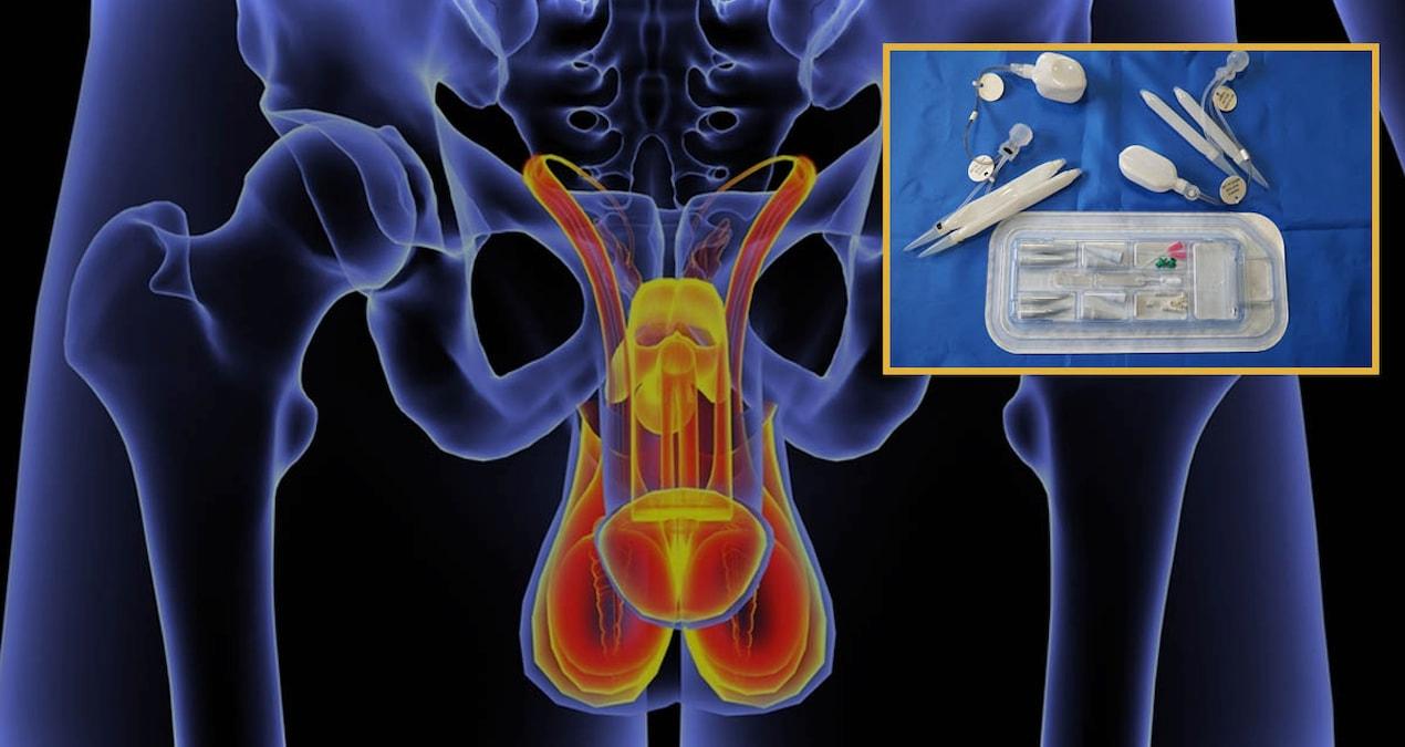 penis-uzunlugunda-sok-kesim-virus-tehlikesine-dikkat-rpQN2Feu.jpg