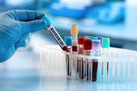 tibbin-gelecegini-sekillendiren-yeni-test-devrimsel-gelismeler-kapida-RftTxFMx.jpg