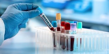 tibbin-gelecegini-sekillendiren-yeni-test-devrimsel-gelismeler-kapida-RftTxFMx.jpg