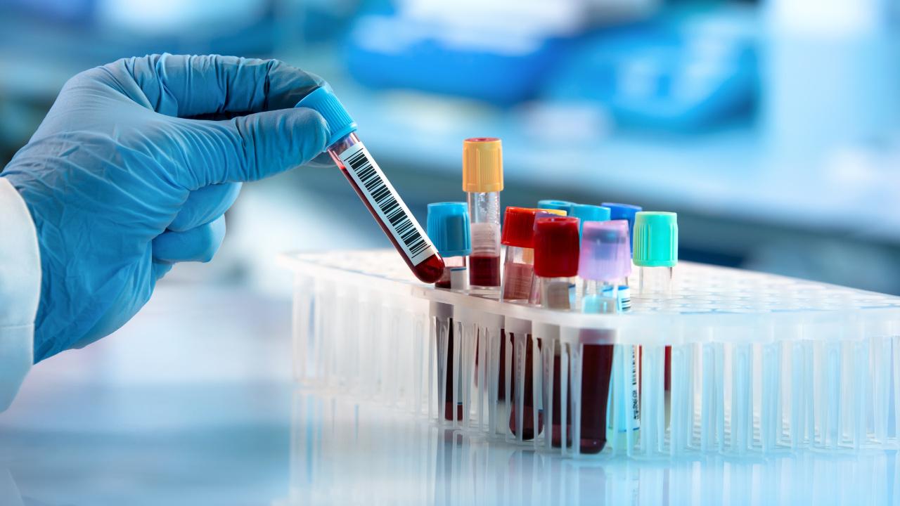 tibbin-gelecegini-sekillendiren-yeni-test-devrimsel-gelismeler-kapida-RftTxFMx.jpg