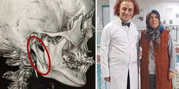15-yildir-cekilen-boyun-agrisinin-gizemi-nadir-hastalik-ortaya-cikti-D4lbtLqO.jpg