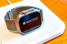 apple-watch-ultra-3-ile-devrim-niteliginde-bir-yenilige-imza-atmaya-hazirlaniyor-JREmUsb4.jpg