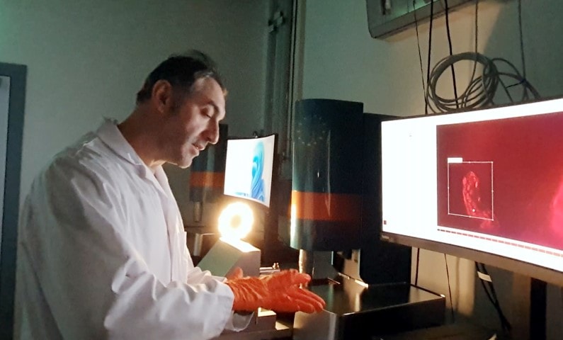 Çöp Gibi Biriken Proteinler