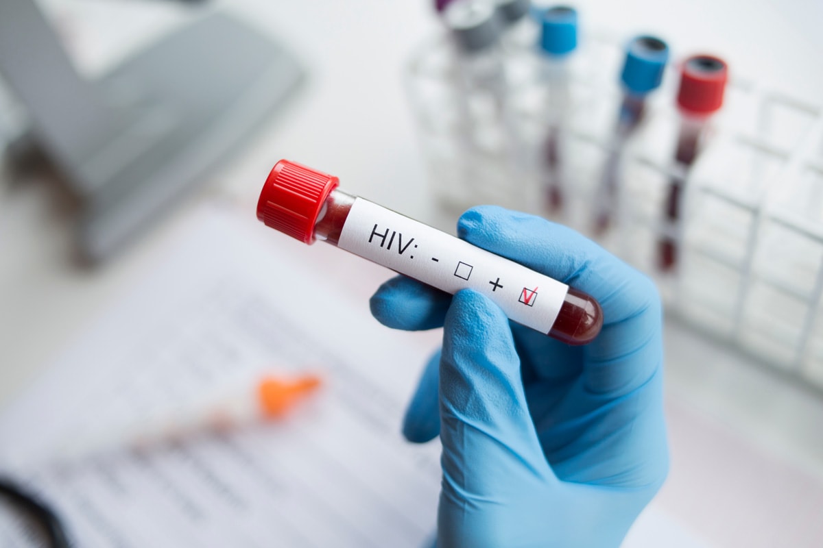 Pek Çok Kişi Şüphelense de Test Yaptırmıyor