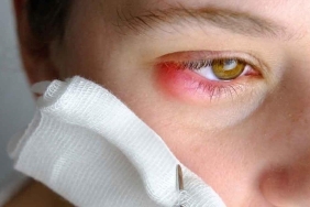 korkutucu-virus-salgini-8-can-aldi-belirtiler-neler-iIZ9jw7u.jpg
