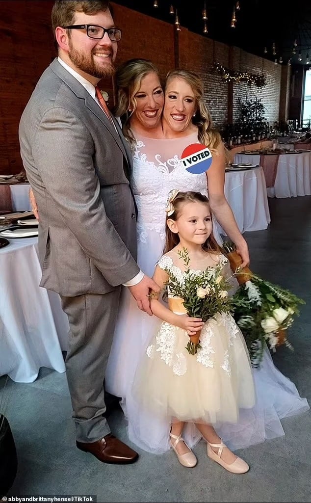 Abby ve Brittany'nin Şaşırtıcı Hikayesi