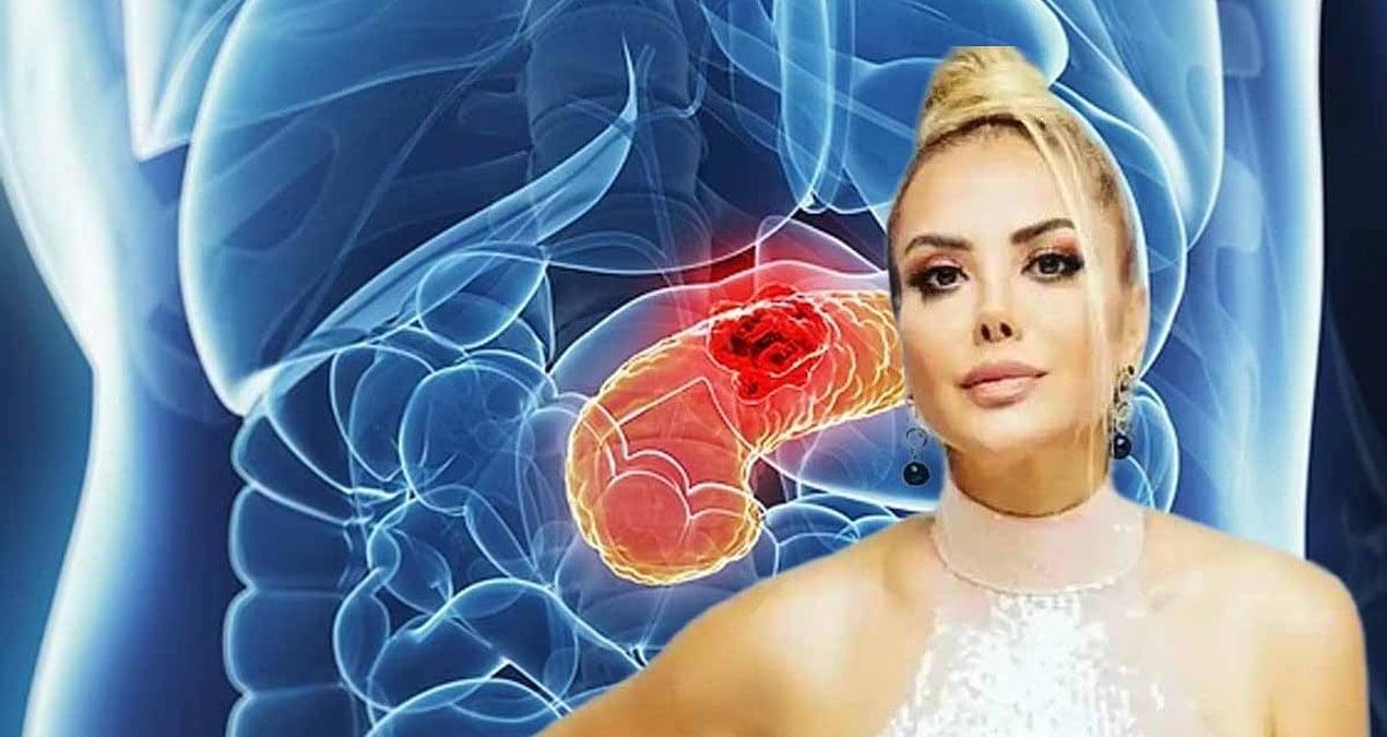 pankreas-kanserinin-belirtileri-tanyelinin-ogrenme-hikayesi-ve-evreler-uzerine-detaylar-IZVhMIDa.jpg