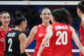 milli-voleybolcu-zehra-gunes-maca-gozlukle-cikti-bir-kismimi-goremiyorum-gorusumu-kaybettim-2yaPX582.jpg