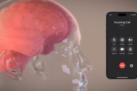 elon-muskun-neuralinki-insanla-bulusuyor-ekimde-ilk-adimlar-ve-gelecegin-neuroteknolojisi-PskTN9bt.jpg