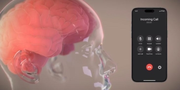 elon-muskun-neuralinki-insanla-bulusuyor-ekimde-ilk-adimlar-ve-gelecegin-neuroteknolojisi-PskTN9bt.jpg