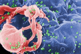 turkiyede-hiv-ile-yasayan-her-uc-kisiden-birinde-frengi-goruldu-yeni-bulgular-ve-etkileri-kkqmbV1x.jpg