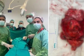 25-milyonda-bir-goruluyor-tam-bir-kilogram-dev-tumor-ameliyatla-cikarildi-mAleuZid.jpg