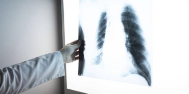 pisen-yemegin-dumani-bile-koaha-yol-acabilir-uzmandan-kritik-uyari-Hrt7RS4L.jpg