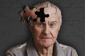 bilim-dunyasindan-yeni-kesif-alzheimer-baslamadan-once-tedavi-edilebilir-mi-8Q4iAdtx.jpg