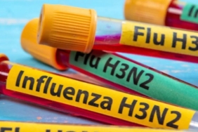 dunyaya-yayilan-yeni-grip-turu-h3n2-7-mutasyon-gecirdi-cok-hizli-bulasiyor-JgmNKEw6.jpg