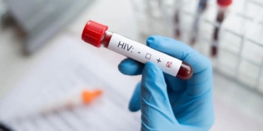 gelecek-10-yilda-77-milyon-kisinin-hiv-nedeniyle-yasamini-yitirecegi-tamamiyla-ongoruldu-emq3Xpf2.jpg