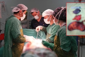 karnindaki-siskinlik-sikayetiyle-hastaneye-basvuran-kisiden-2-kilo-200-gram-agirliginda-tumor-cikarildi-4G5Dk5bz.jpg