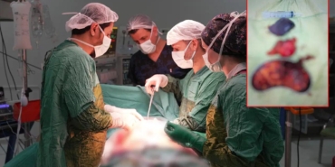 karnindaki-siskinlik-sikayetiyle-hastaneye-basvuran-kisiden-2-kilo-200-gram-agirliginda-tumor-cikarildi-4G5Dk5bz.jpg
