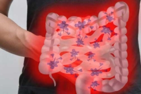tedavi-edilmemis-inflamatuvar-bagirsak-hastaliklari-icin-web-icerigi-ciddi-riskler-ve-onlemler-WDncI1QK.jpg