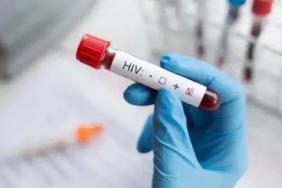 turkiyede-hiv-gercegi-son-10-yilda-yasanan-460-artisin-gercekleri-ve-riskler-Xt2b5E4O.jpg