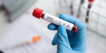 turkiyede-hiv-gercegi-son-10-yilda-yasanan-460-artisin-gercekleri-ve-riskler-Xt2b5E4O.jpg