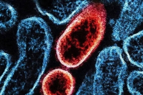 nipah-virusu-nedir-nasil-yayilir-ve-ne-kadar-tehlikelidir-guncel-bilgiler-U7ckRsMy.jpg