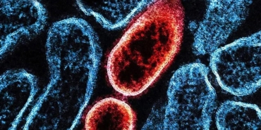 nipah-virusu-nedir-nasil-yayilir-ve-ne-kadar-tehlikelidir-guncel-bilgiler-U7ckRsMy.jpg