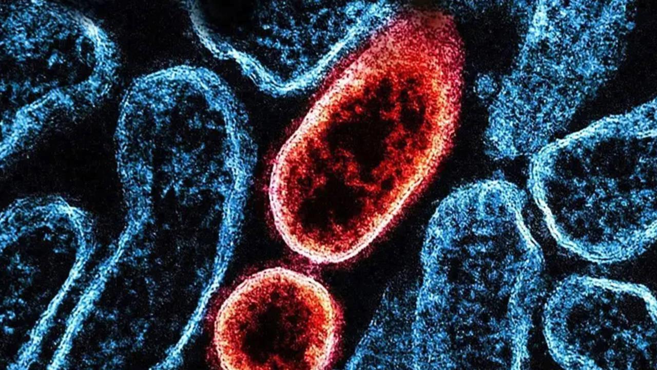 nipah-virusu-nedir-nasil-yayilir-ve-ne-kadar-tehlikelidir-guncel-bilgiler-U7ckRsMy.jpg